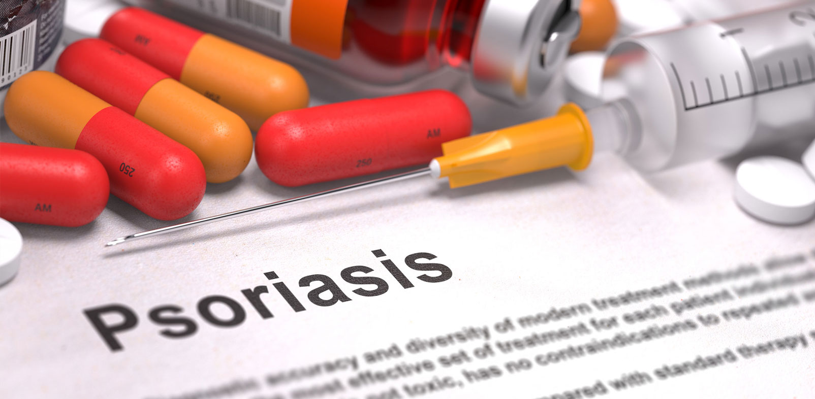 Psoriasis Treatment Is Necessary To Heal the Infected Skin